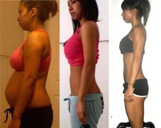 Post-weight-loss Body Shaping Treatment suppliers